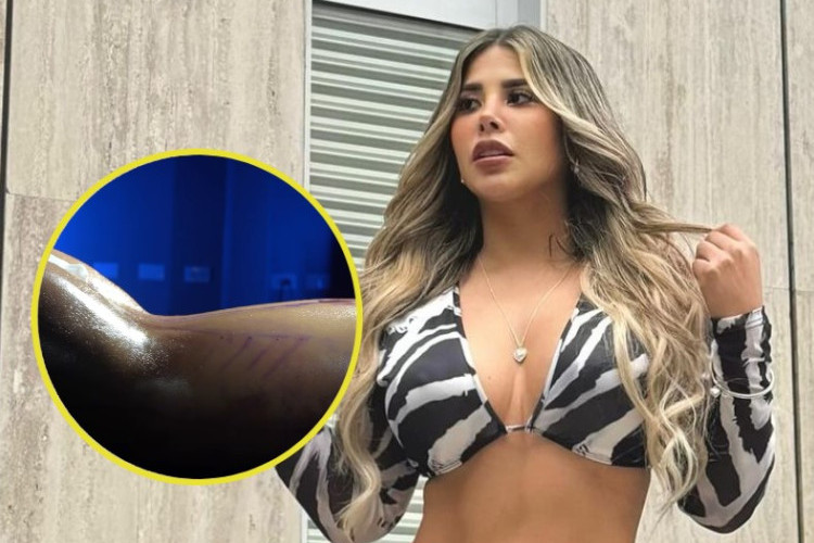 Enlace Vídeo Gabriela Serpa Revela Que Aldo Miyashiro Le Tiró Maíz, Aquí Está La Imagen Real 