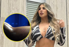 Enlace Vídeo Gabriela Serpa Revela Que Aldo Miyashiro Le Tiró Maíz, Aquí Está La Imagen Real 